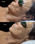 PLLA Korean Volume Facial w/ Stem Cell Mist Home Kit