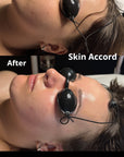 Custom Facial Treatment
