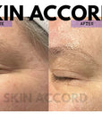 Dr.Esthe C Tox Eye Cream - SKIN ACCORD