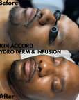 Korean Hydra Glass Facial