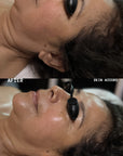 Korugi Sculpting Facial Massage