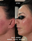 Korugi Sculpting Facial Massage
