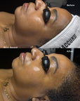 Skin Accord Peel Program