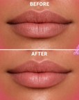 KRX Aesthetics Lip Darts Before and after comparison of lips with 'Skin Accord' brand name.