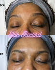 MBK Eye Rejuvenator