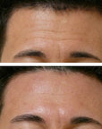NeoGenesis Skin Serum Regenerative Support  20% S²RM® - SKIN ACCORD