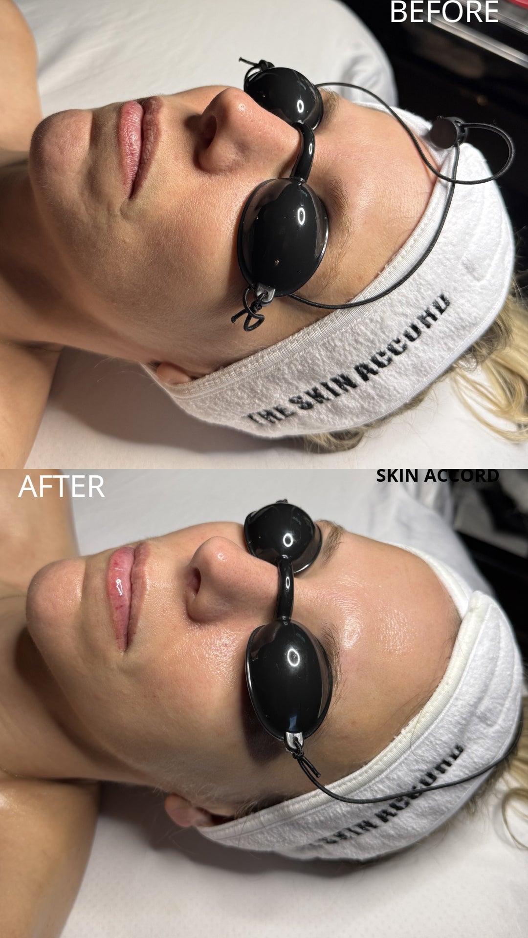 Reverse - Korean Anti-Aging Facial Treatment