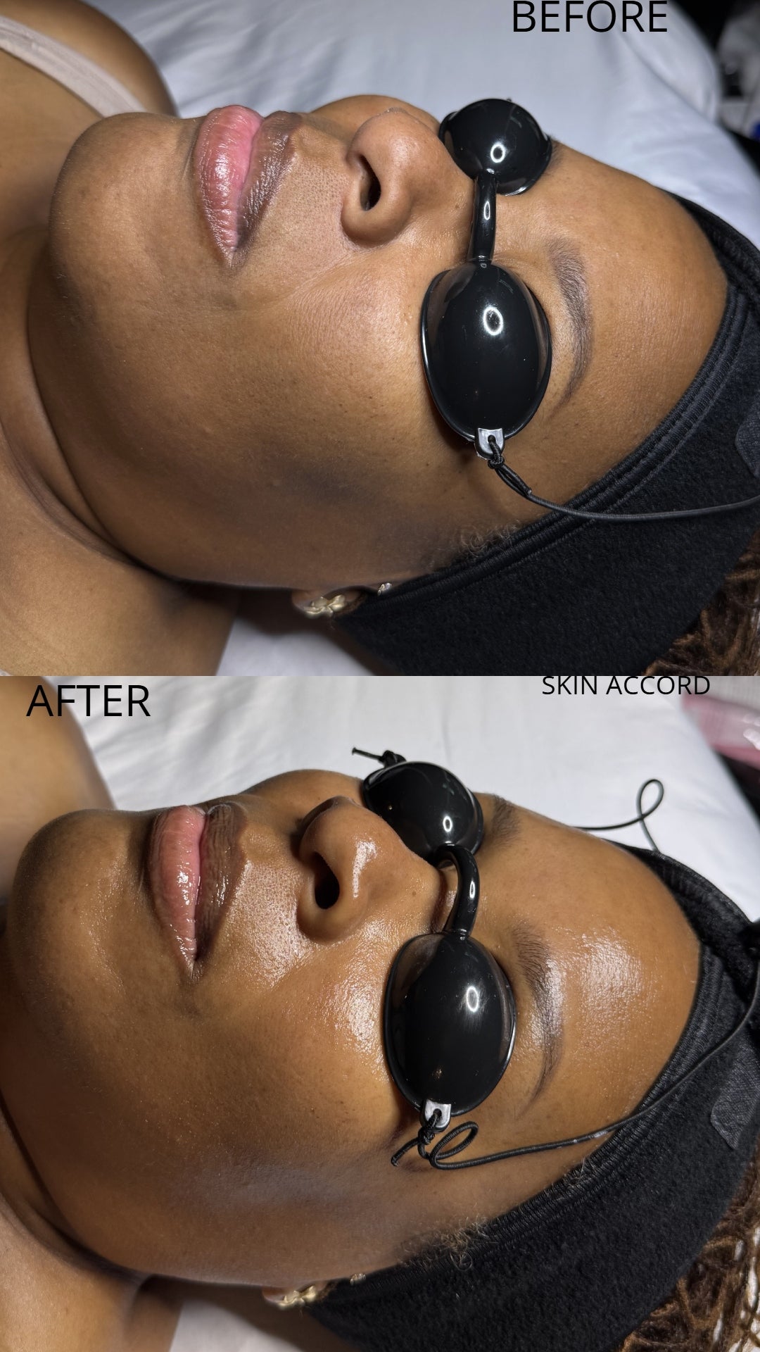 Brightening - Korean Signature Facial