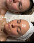 Barrier Reset - Intro Facial