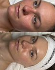 Custom Facial Treatment