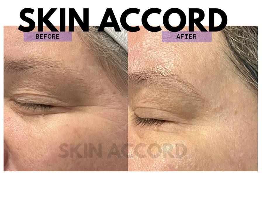 MBK Eye Rejuvenator