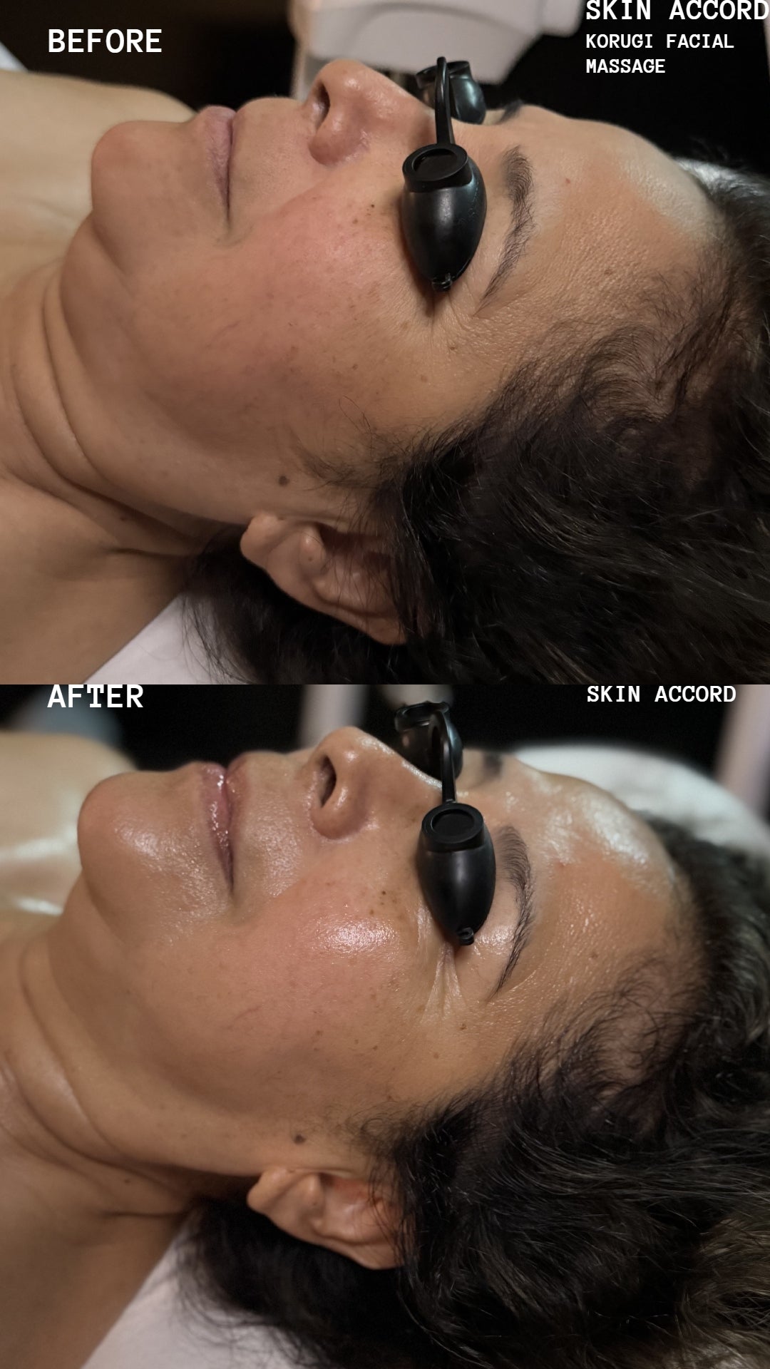Korugi Sculpting Facial Massage