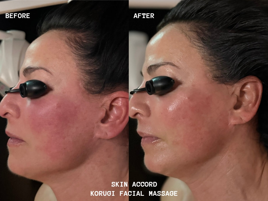 Korugi Sculpting Facial Massage