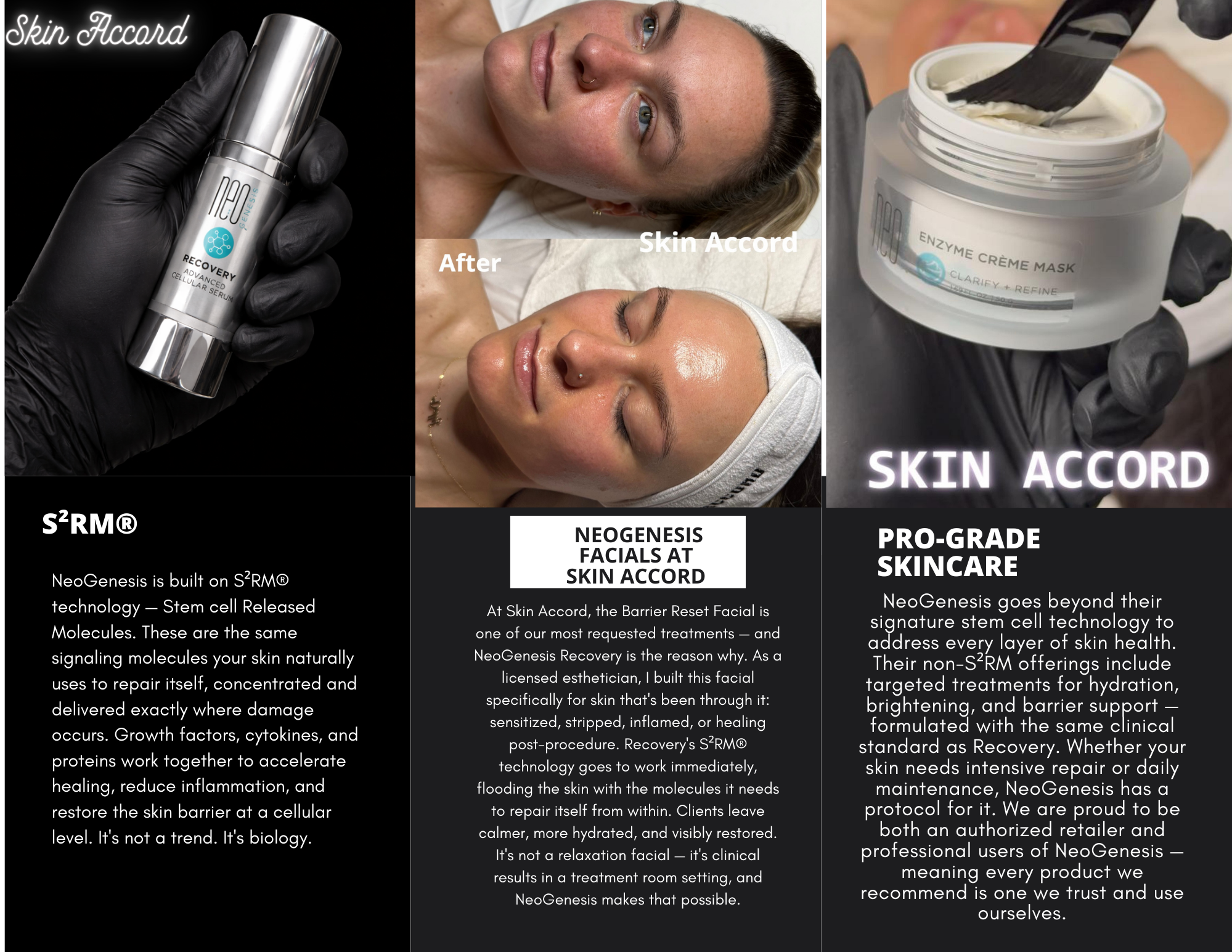 NeoGenesis Recovery Serum Advanced Cellular Serum 70% S²RM® - SKIN ACCORD