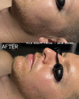 Skin Accord Korean Treatment Membership