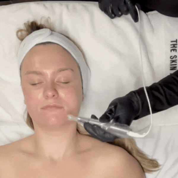 Regenerative Infusion Facial - SKIN ACCORD