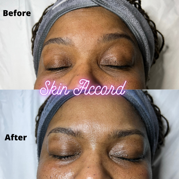MBK Eye Rejuvenator