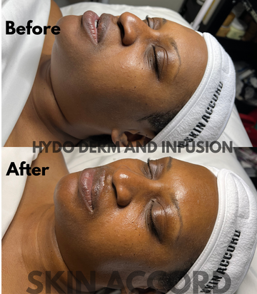 Brightening Facial Treatment