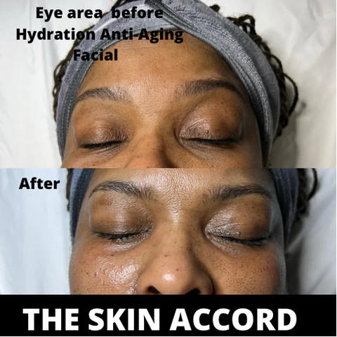 Anti-Aging Facial Treatment